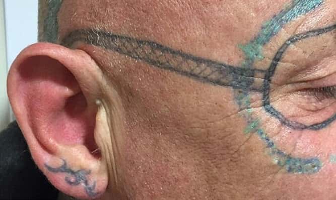 La peor resaca: se fue de fiesta y despertó con un horrendo tatuaje en la cara