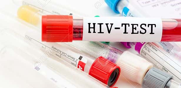 En el país, 3 de cada 10 diagnósticos de VIH son tardíos