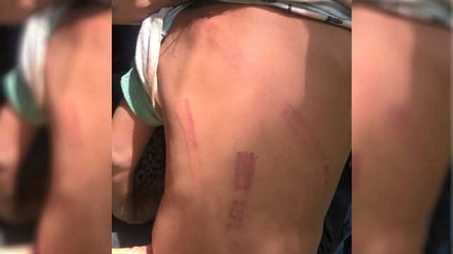 Imputaron a una entrerriana por torturar a sus hijos de 2, 4 y 6 años