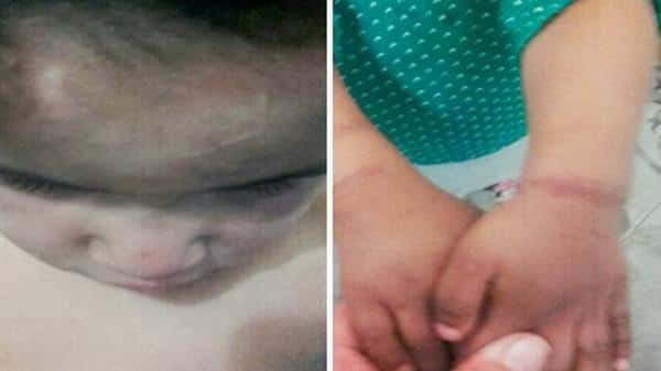 Tres bebés eran atados, golpeados y quemados por sus padres