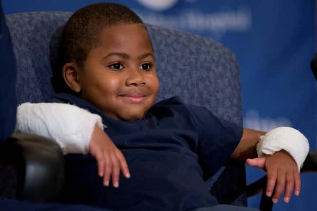 VIDEO: Niño de 8 años recibió doble trasplante de manos