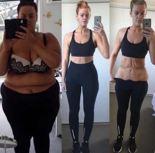 El mensaje de la mujer que bajó 85 kg. y la trataron de mentirosa