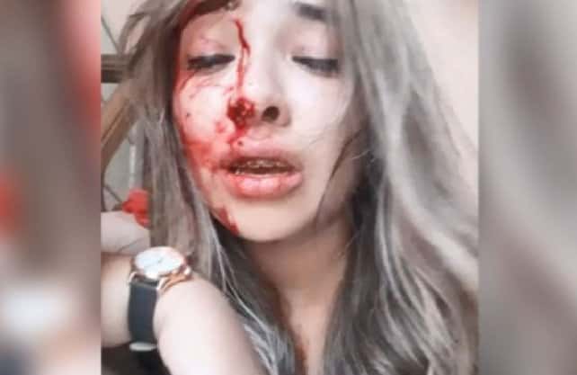Su novio la golpeó brutalmente: lo escrachó mostrando cómo la desfiguró
