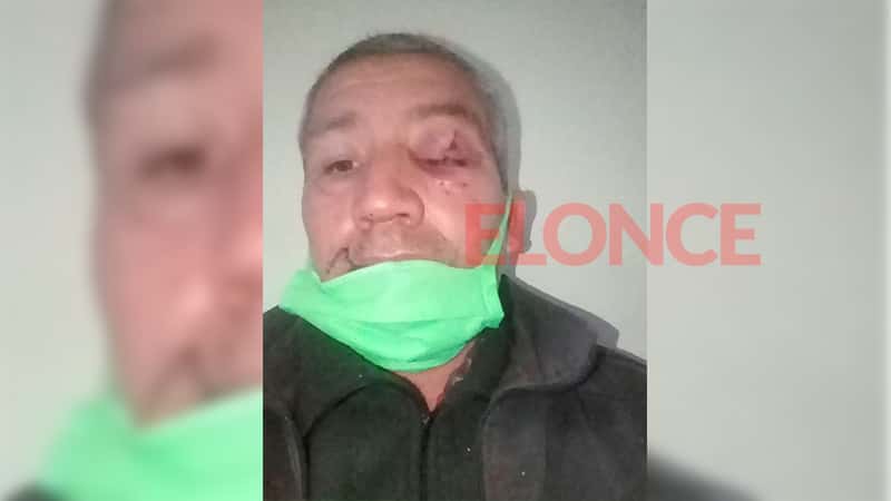 Violentísimo asalto en panadería: Golpearon a la empleada y al dueño