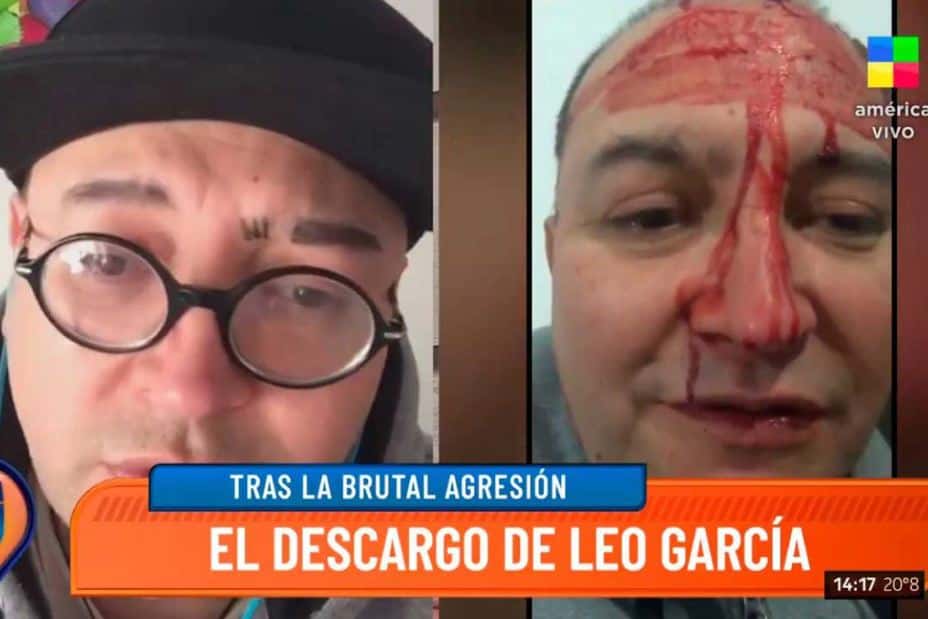 Las imágenes que contradicen el relato de Leo García sobre el supuesto "ataque homofóbico"