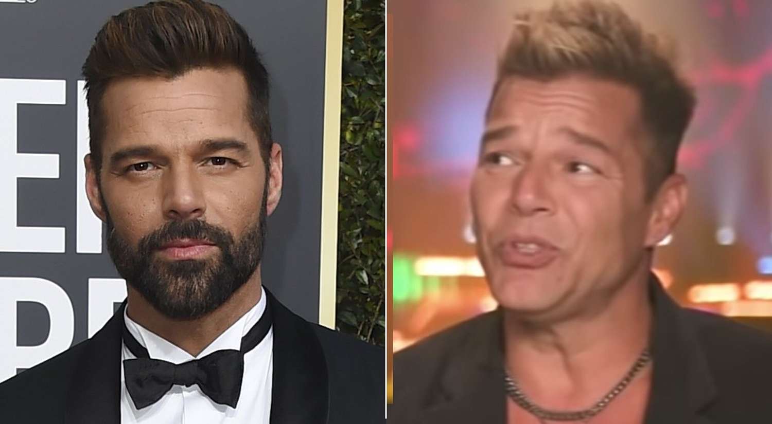 Ricky Martin se hizo un retoque en la cara y quedó igual a Burlando