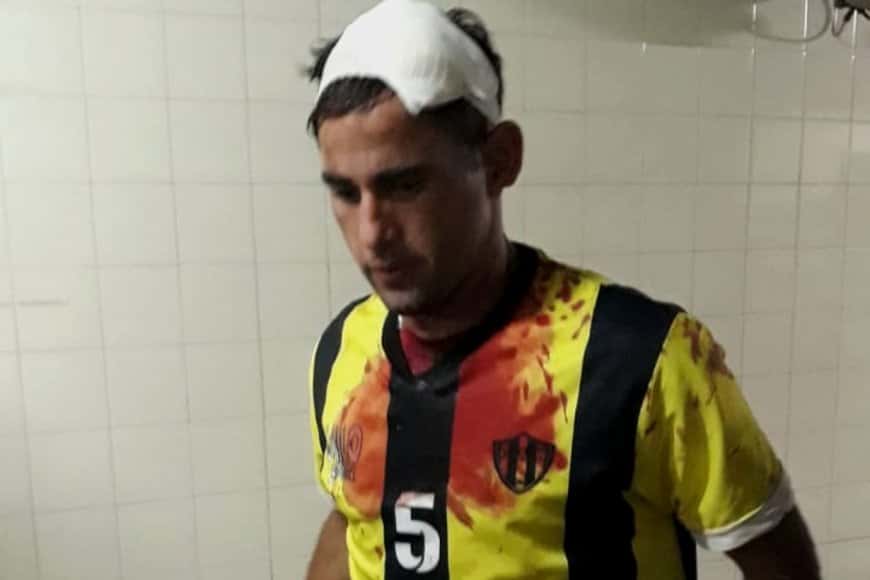 Un partido de fútbol terminó con hospitalizados y heridos de balas de goma