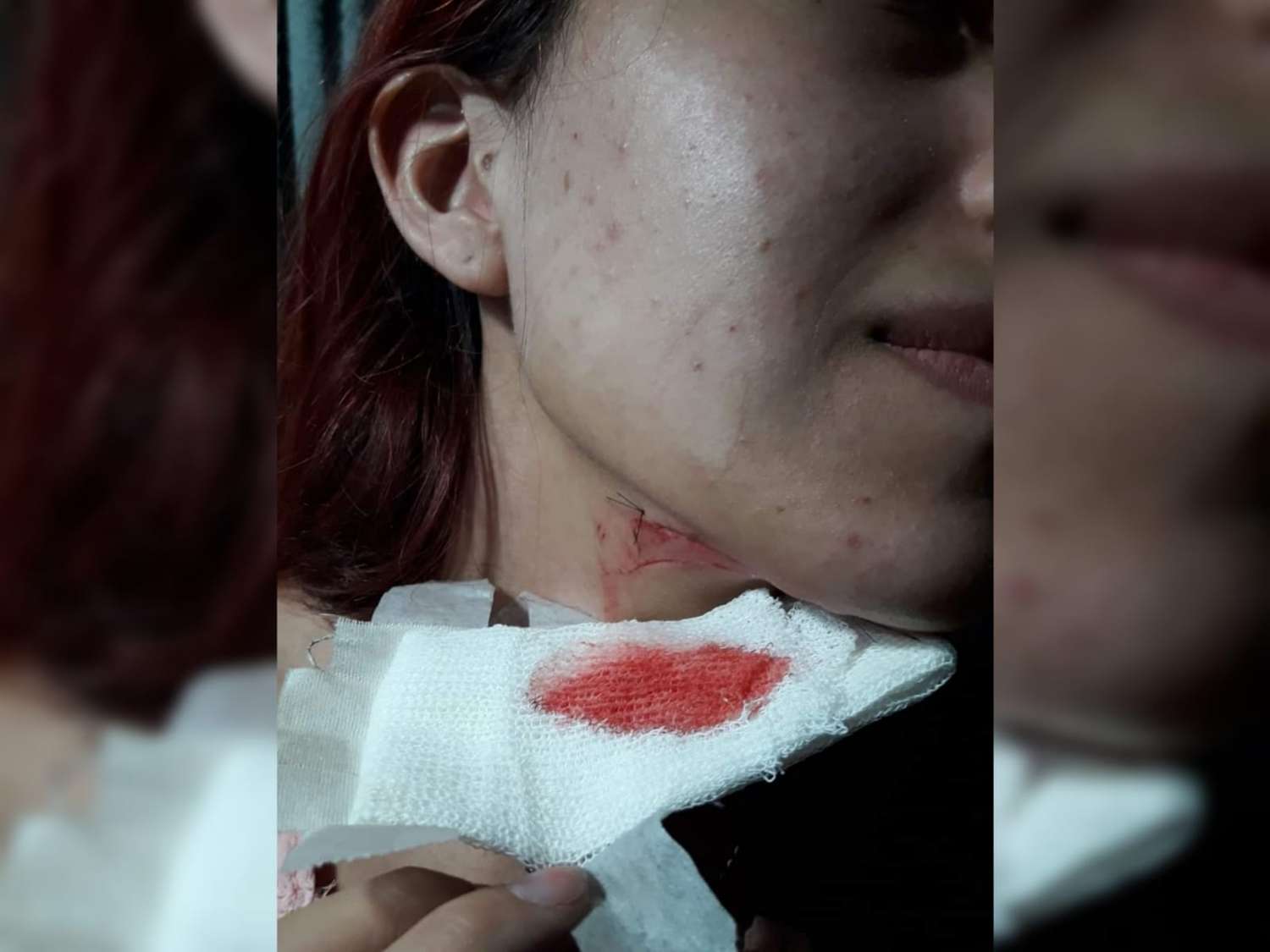 Violento robo a una joven en Gualeguaychú: le cortaron el cuello por un celular