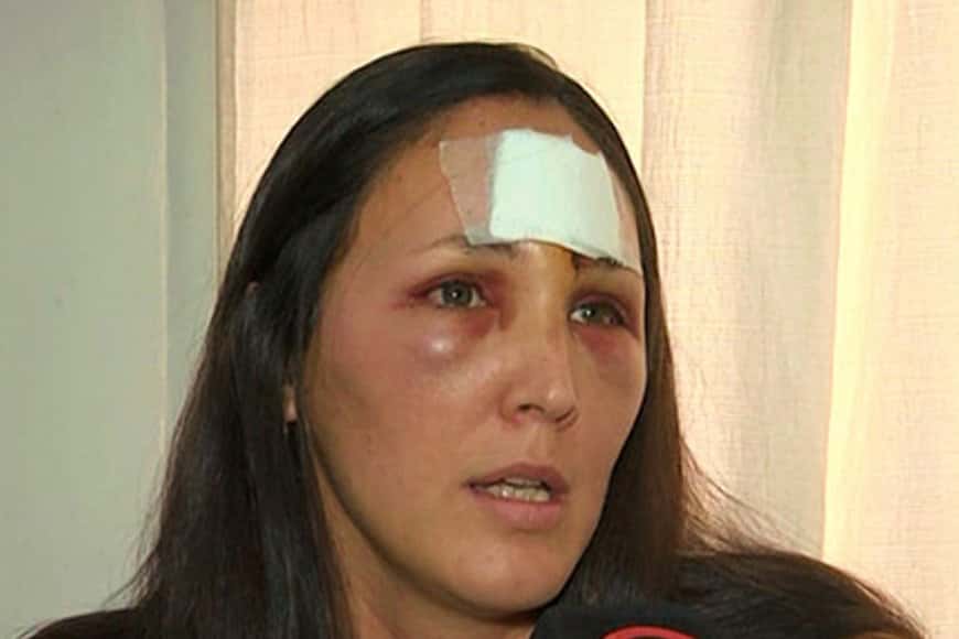 Una docente recibió piedrazo en el rostro durante una manifestación: tuvieron que hacerle 10 puntos de sutura
