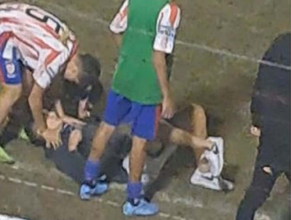 Grave episodio de violencia en el fútbol juvenil: un jugador fue agredido y sufrió una grave doble fractura