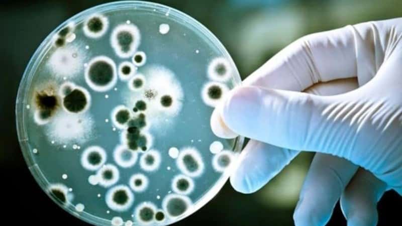 Qué es el Streptococcus pyogenes que ya causó 16 muertes en el país