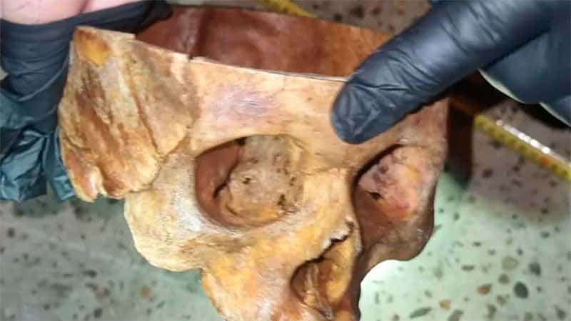 Hallaron un cráneo humano en una vereda de una localidad entrerriana