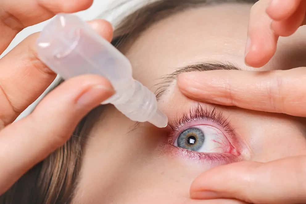 La presión ocular en el glaucoma y otras variables